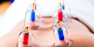 بهترین زمان حجامت چه موقعی است؟