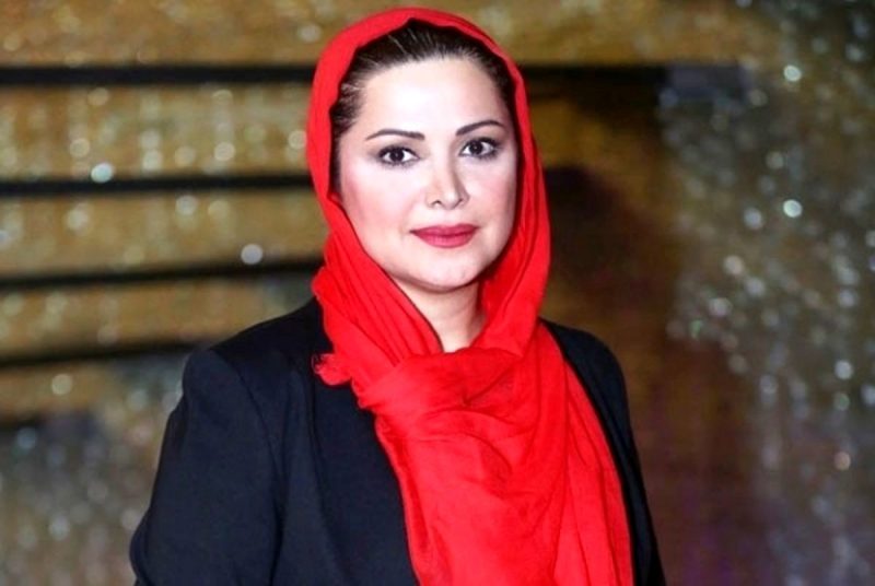 مقایسه چهره کمند امیرسلیمانی قبل و بعد از عمل +عکس