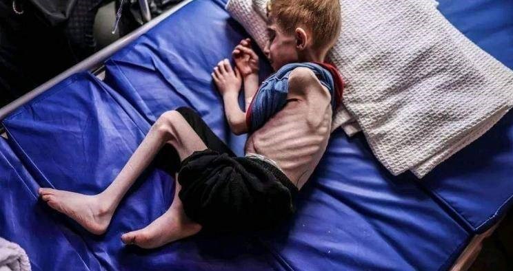 ۲۹۰ هزار کودک در نوار غزه در آستانه مرگ