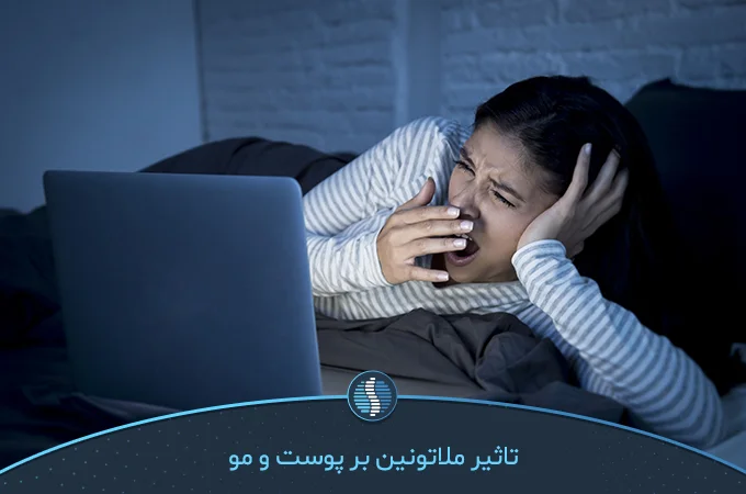 نقش ملاتونین و خواب در ریزش مو و کدری پوست بانوان
