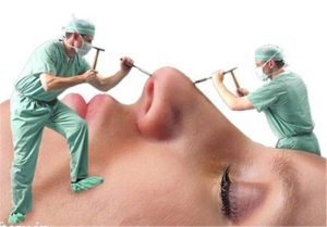 هجوم پزشکان به جراحی‌های زیبایی / زیبایی سود دارد، درمان نه