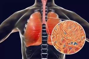 آلودگی هوا ریه را ضعیف می‌کند