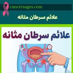 ۴ علامت شایع و گمراه کننده سرطان مثانه